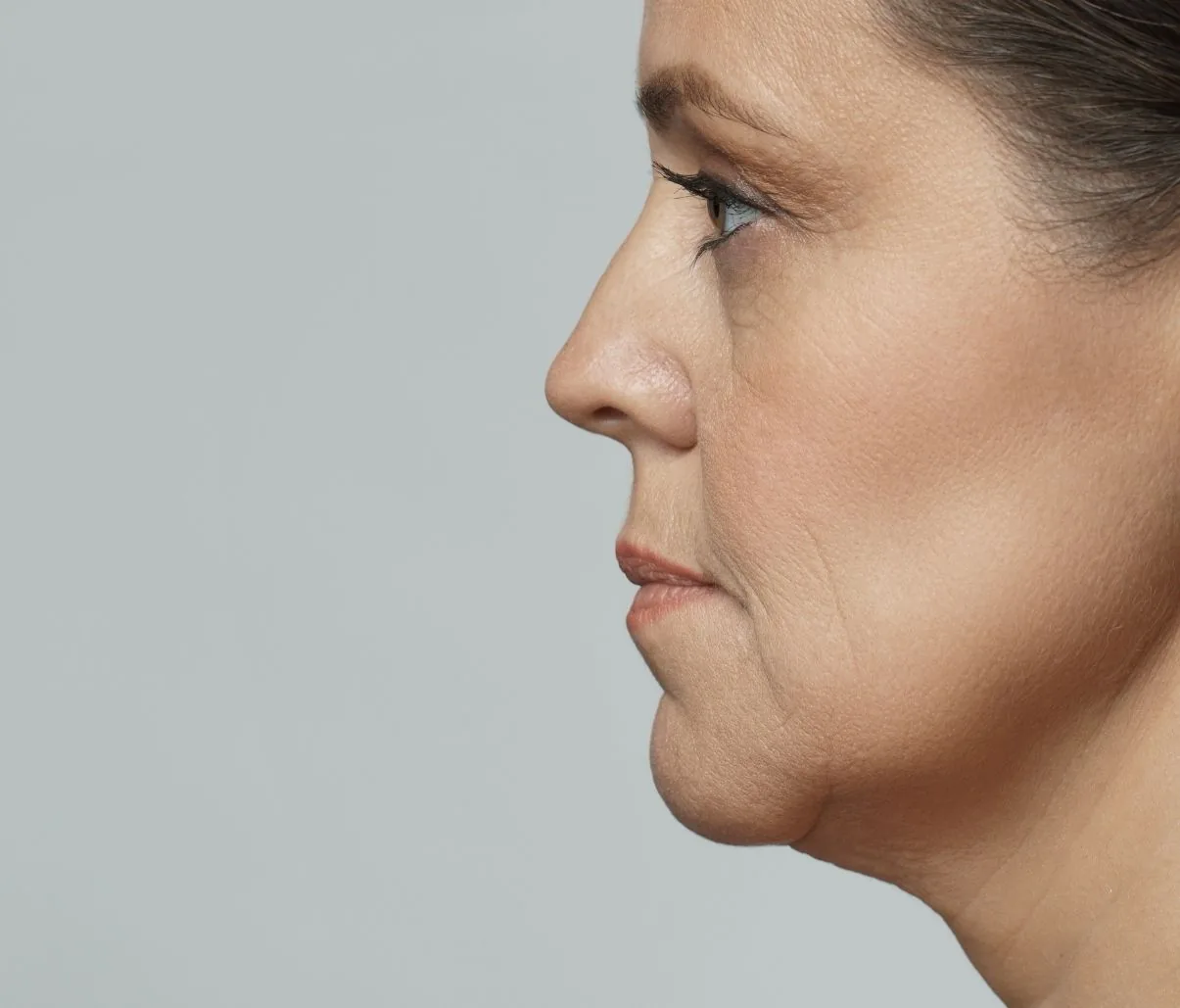Profile photograph of a woman&rsquo;s lower face, showing the jawline and the area beneath the chin.