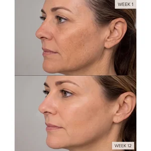 Customer results at week 0 and week 6, neck and collarbone area